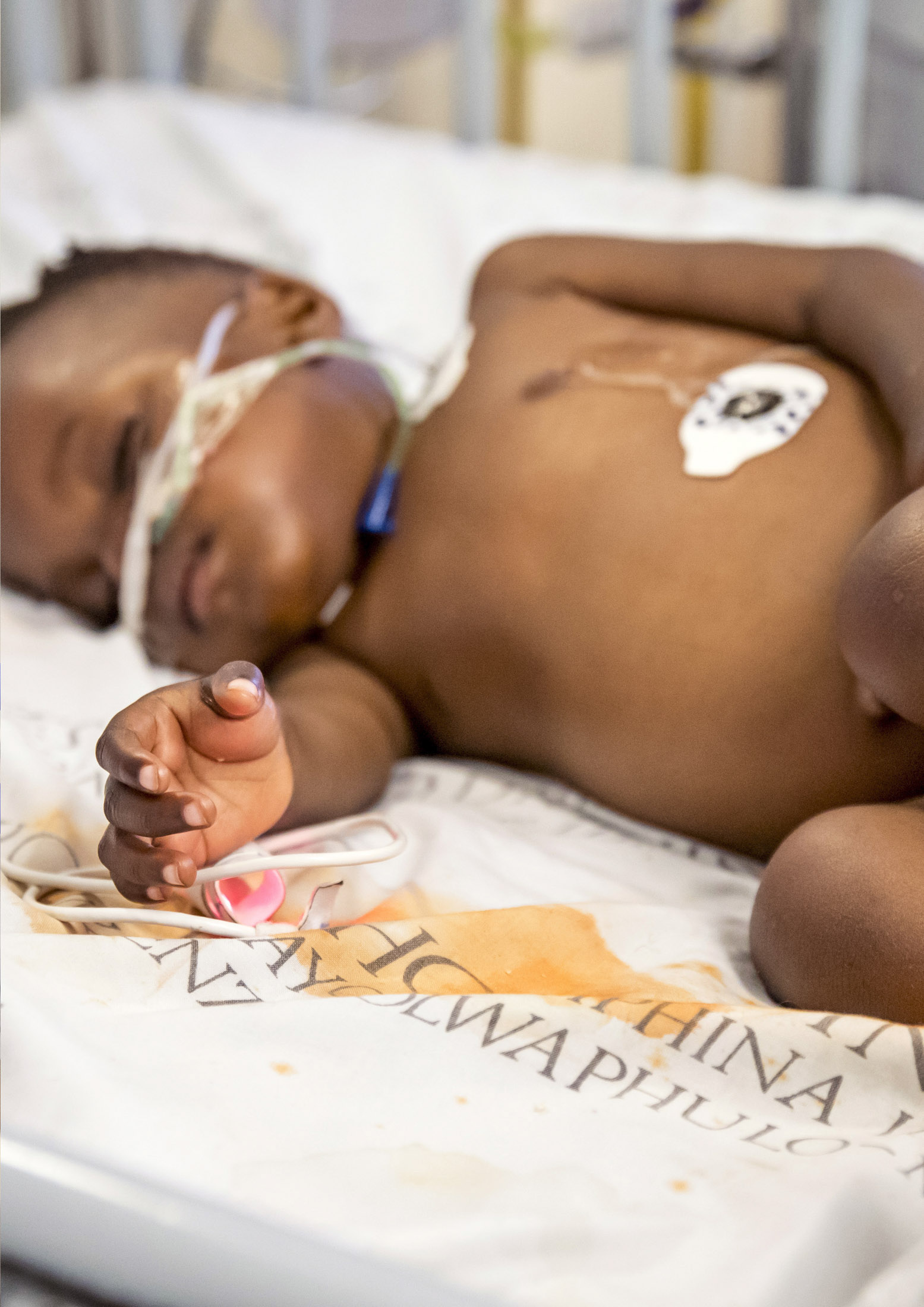 Ein Neugeborenes mit dunkler Haut, das ein Krankenhausarmband und Überwachungssensoren trägt, schläft auf einer Decke. Der Fokus liegt auf der Hand des Babys. © Fotografie Tomas Rodriguez
