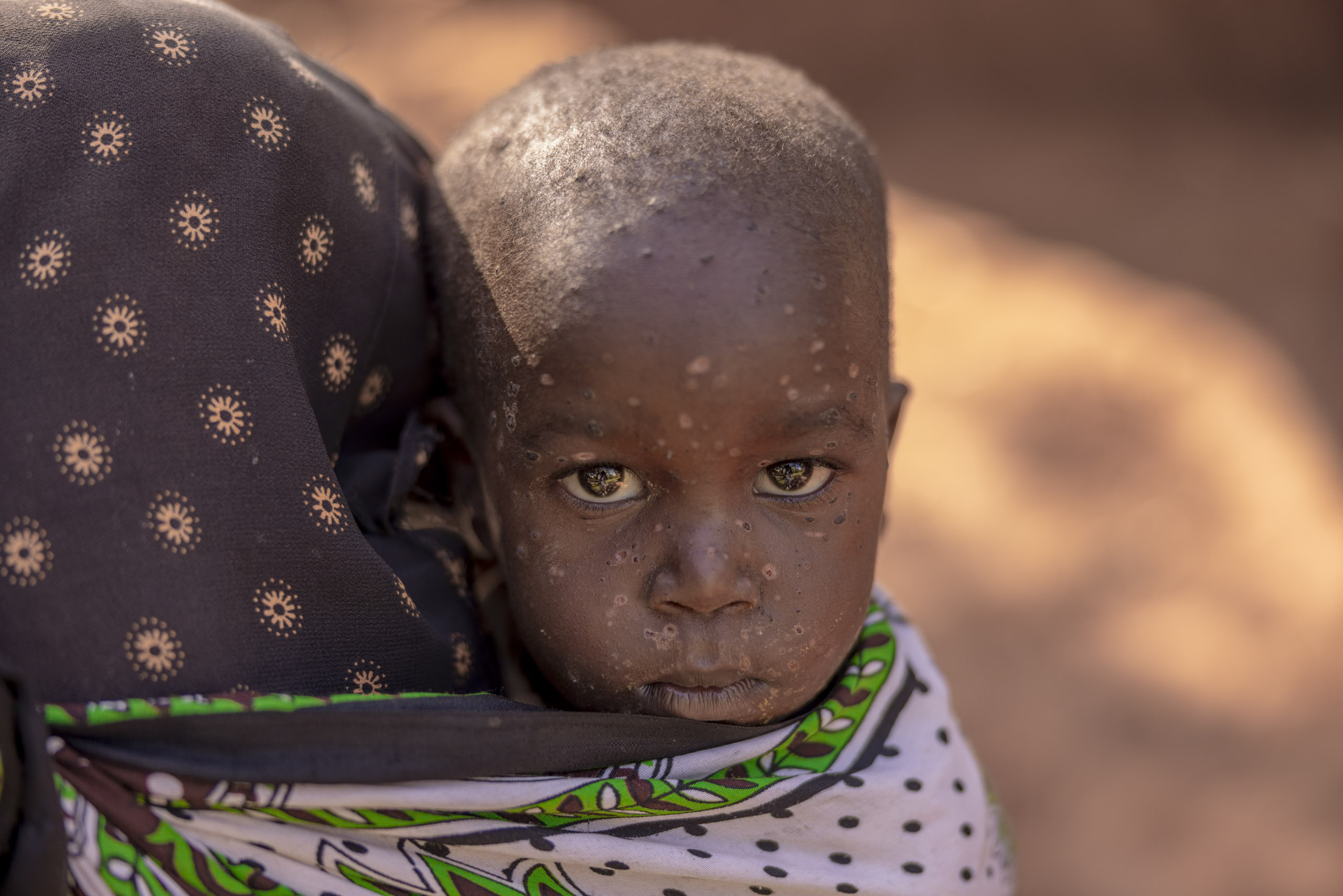 Ein kleines Kind mit auffälligen Augen blickt in einer natürlichen Umgebung im Freien über eine gemusterte Stofftrage, die ein Erwachsener auf dem Rücken trägt. Das Gesicht des Kindes ist mit leichtem Staub bedeckt. © Fotografie Tomas Rodriguez