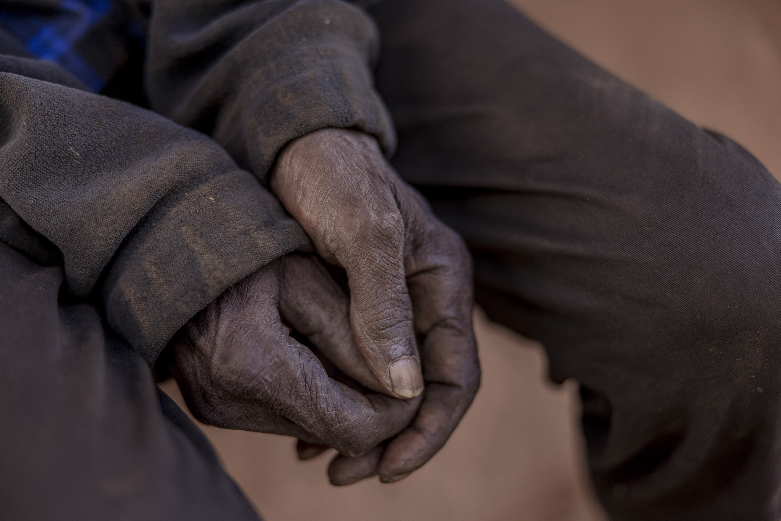 Nahaufnahme der Hände einer Person, bedeckt mit Schmutz und Dreck, über den Knien gefaltet. Die Hände sind rau und abgenutzt, was auf harte körperliche Arbeit schließen lässt. © Fotografie Tomas Rodriguez