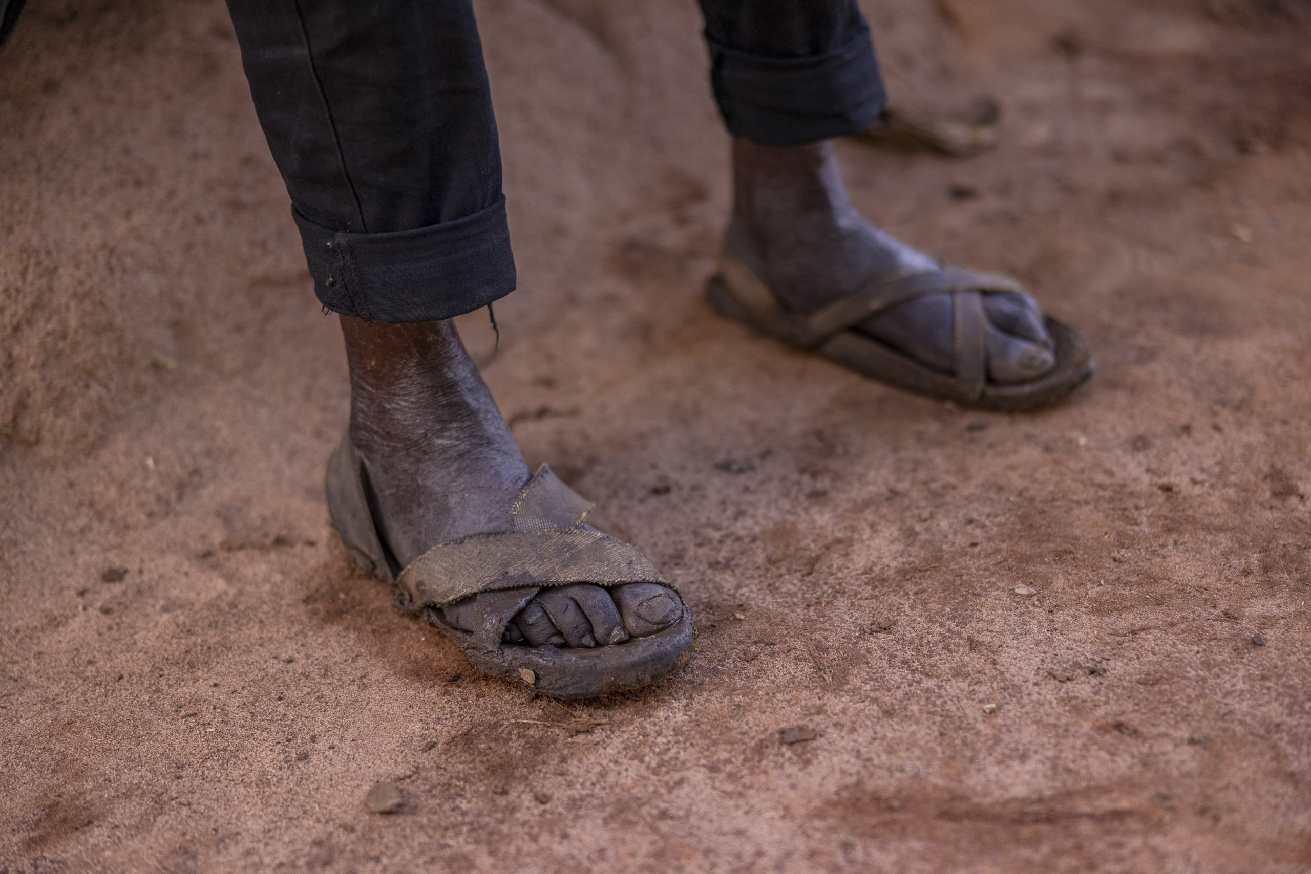 Nahaufnahme der Füße einer Person in abgenutzten Sandalen auf schmutzigem Boden, was Armut und harte Lebensbedingungen verdeutlicht. © Fotografie Tomas Rodriguez