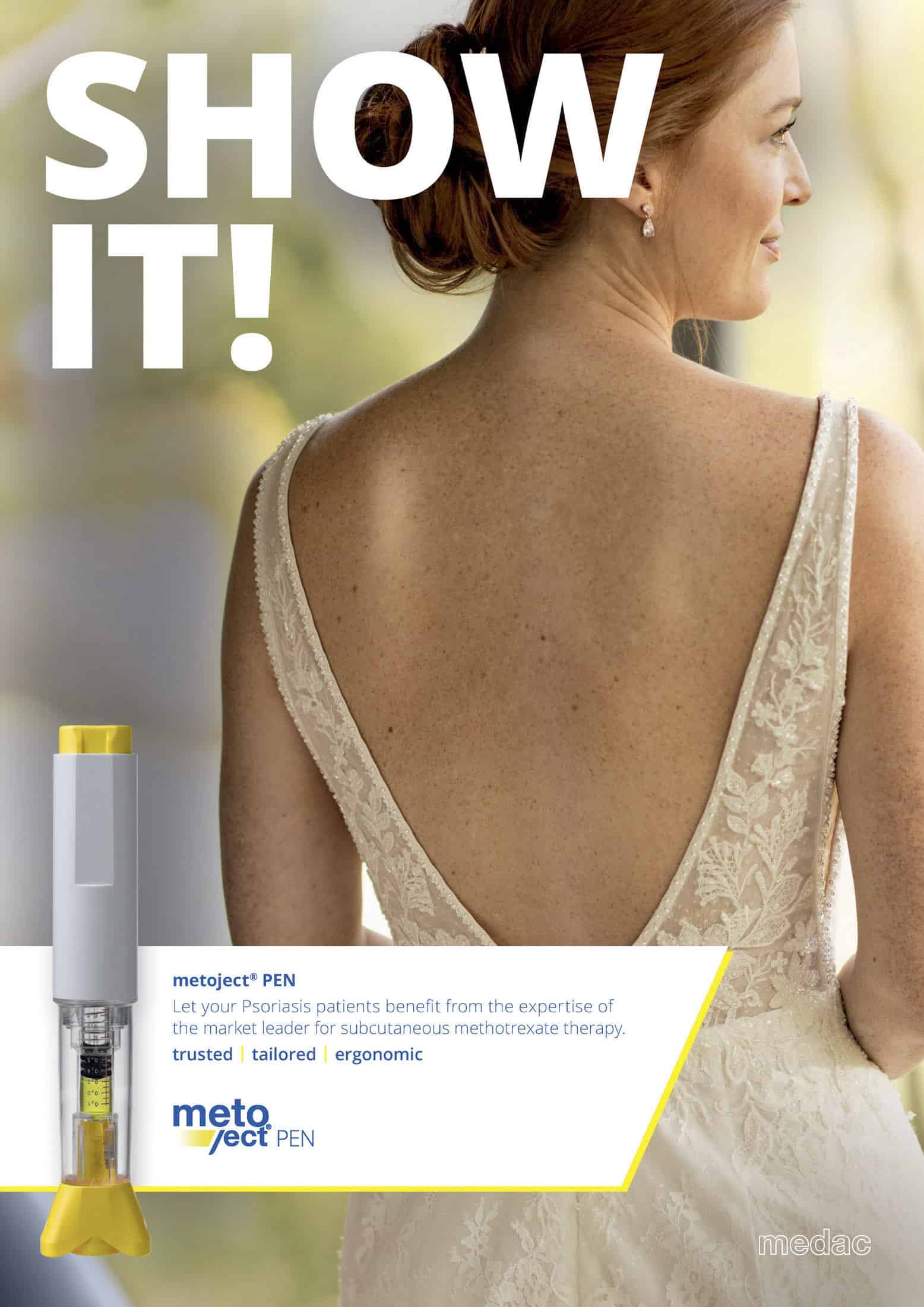 Eine Frau in einem ärmellosen Kleid steht mit dem Rücken zur Kamera und zeigt ihre reine Haut. Der eingeblendete Text wirbt für den metoject PEN, ein Medikament gegen Schuppenflechte, und zeigt in der Ecke ein Bild des Stiftes. © Fotografie Tomas Rodriguez